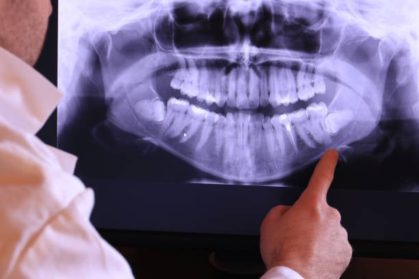 Best Emergency TMJ Treatment in North Webster, IN